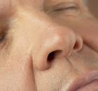 podagra, ból, dna moczanowa